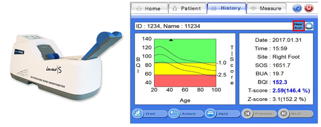 Prevenție Osteoporoză: Ghid Complet pentru Sănătatea Oaselor